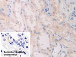SLIT1 Polyclonal Antibody