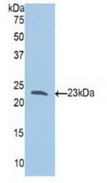 SLIT1 Antibody in Western Blot (WB)