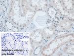 SNRPD1 Antibody in Immunohistochemistry (Paraffin) (IHC (P))