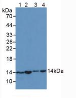 SNRPD1 Antibody in Western Blot (WB)