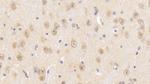 SNUPN Polyclonal Antibody
