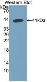 SNUPN Antibody in Western Blot (WB)