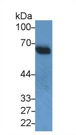 SNUPN Antibody in Western Blot (WB)