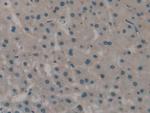 CD298 Antibody in Immunohistochemistry (Paraffin) (IHC (P))