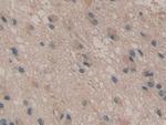CD298 Antibody in Immunohistochemistry (Paraffin) (IHC (P))