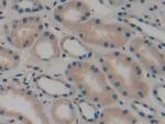 CD298 Antibody in Immunohistochemistry (Paraffin) (IHC (P))