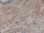 CD298 Antibody in Immunohistochemistry (Paraffin) (IHC (P))