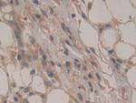 CD298 Antibody in Immunohistochemistry (Paraffin) (IHC (P))