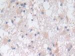 SNX13 Antibody in Immunohistochemistry (Paraffin) (IHC (P))