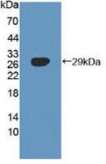 SNX13 Antibody in Western Blot (WB)
