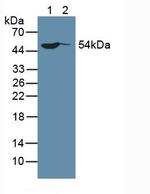 SP100 Antibody in Western Blot (WB)