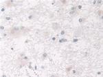 SPARCL1 Antibody in Immunohistochemistry (Paraffin) (IHC (P))