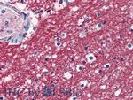 SPARCL1 Antibody in Immunohistochemistry (Paraffin) (IHC (P))