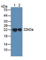 Sp17 Antibody in Western Blot (WB)