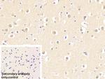 SKP1 Polyclonal Antibody