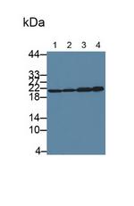 SKP1 Antibody in Western Blot (WB)