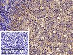 Syk Polyclonal Antibody