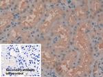 Syk Antibody in Immunohistochemistry (Paraffin) (IHC (P))