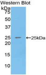 SPRY3 Antibody in Western Blot (WB)