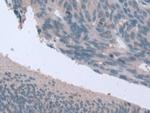 STIP1 Polyclonal Antibody