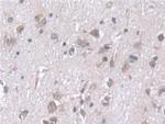 STIP1 Antibody in Immunohistochemistry (Paraffin) (IHC (P))