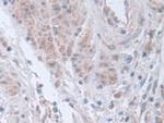STIP1 Antibody in Immunohistochemistry (Paraffin) (IHC (P))