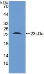 STIP1 Antibody in Western Blot (WB)