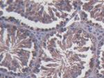SDF2L1 Polyclonal Antibody