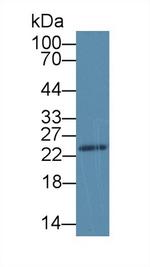 SDF2L1 Antibody in Western Blot (WB)