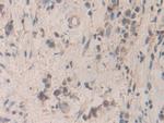 SMC3 Polyclonal Antibody