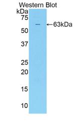 SULF2 Antibody in Western Blot (WB)