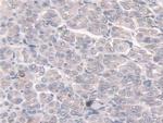 SULF2 Polyclonal Antibody