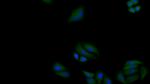 SOD2 Polyclonal Antibody
