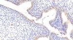 SOD2 Antibody in Immunohistochemistry (Paraffin) (IHC (P))