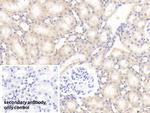 SOD2 Antibody in Immunohistochemistry (Paraffin) (IHC (P))