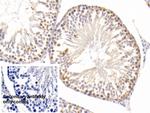 SOD2 Antibody in Immunohistochemistry (Paraffin) (IHC (P))