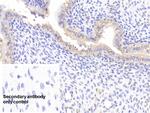 SOD2 Antibody in Immunohistochemistry (Paraffin) (IHC (P))