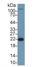 SOD2 Antibody in Western Blot (WB)