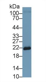 SOD2 Antibody in Western Blot (WB)