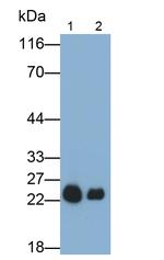 SOD2 Antibody in Western Blot (WB)