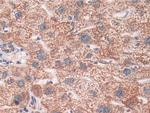 SOD2 Antibody in Immunohistochemistry (Paraffin) (IHC (P))