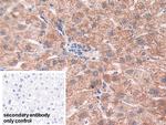 SOD2 Antibody in Immunohistochemistry (Paraffin) (IHC (P))