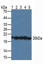 SOD2 Antibody in Western Blot (WB)