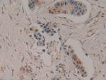 CCS Polyclonal Antibody