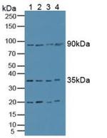 CCS Antibody in Western Blot (WB)