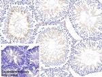 SOCS2 Antibody in Immunohistochemistry (Paraffin) (IHC (P))