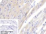 SOCS2 Polyclonal Antibody