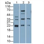 SOCS2 Antibody in Western Blot (WB)