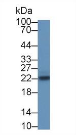 SOCS2 Antibody in Western Blot (WB)