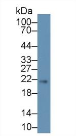 SOCS2 Antibody in Western Blot (WB)